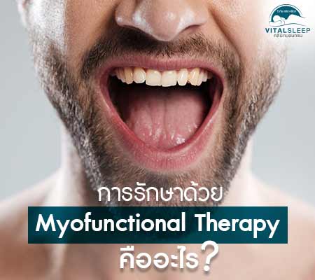 Myofunctional Therapy รักษานอนกรน แก้นอนกรน หยุดหายใจขณะหลับ